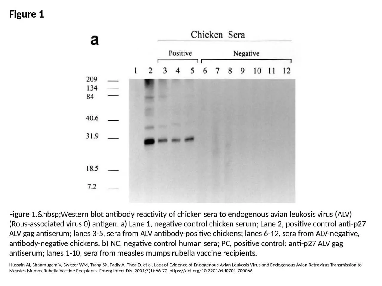 Figure 1 Figure 1.&nbsp;Western blot antibody reactivity of chicken sera to endogenous