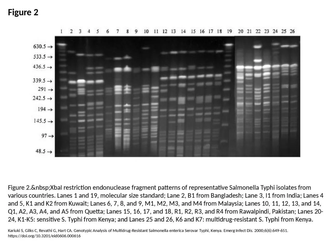 Figure 2 Figure 2.&nbsp;XbaI restriction endonuclease fragment patterns of representative
