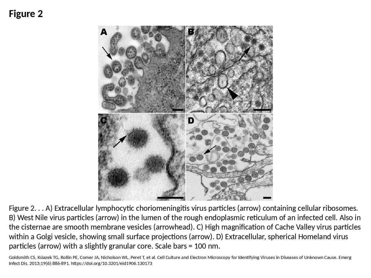 Figure 2 Figure 2. . . A) Extracellular lymphocytic choriomeningitis virus particles (arrow)