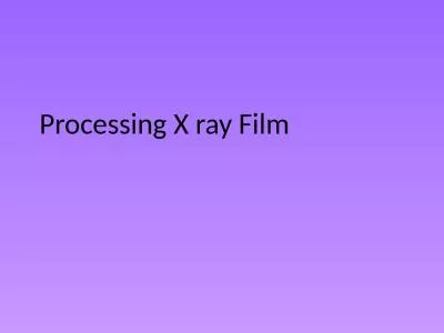 Processing X ray Film Formation of the latent image