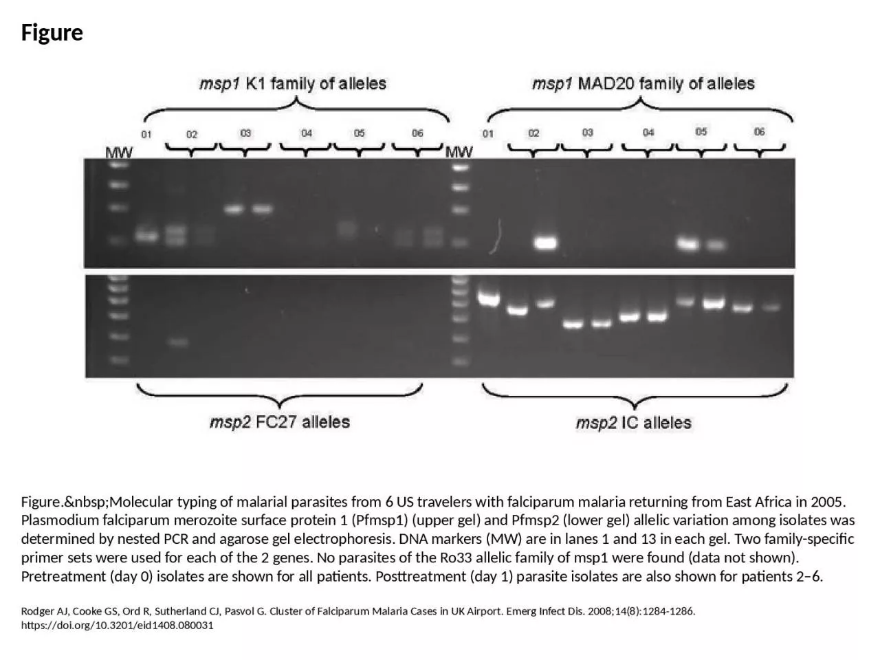 Figure Figure.&nbsp;Molecular typing of malarial parasites from 6 US travelers with