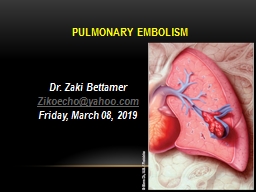 pulmonary embolism Dr.  Zaki