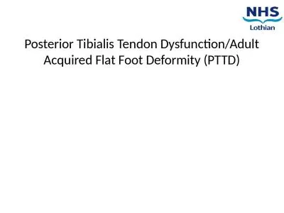 Posterior Tibialis Tendon Dysfunction/Adult Acquired Flat Foot Deformity (PTTD)