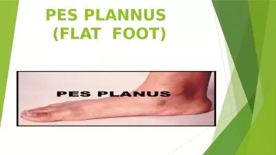 PES PLANNUS (FLAT  FOOT)