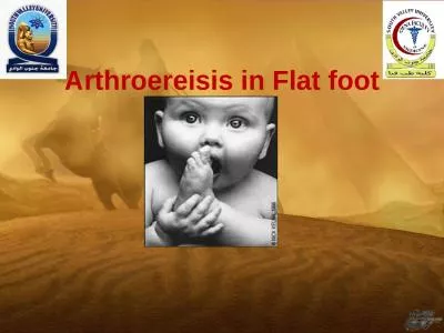 Arthroereisis in Flat foot
