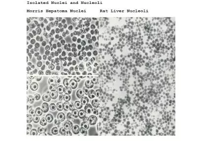 EM Pictures of Isolated Nuclei and Nucleoli of Rat Liver Cells
