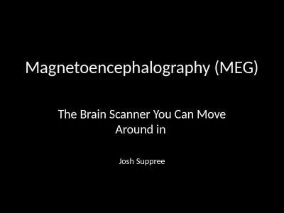 Magnetoencephalography (
