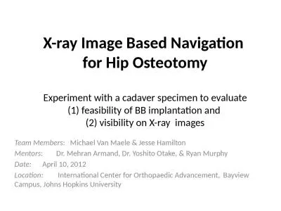 X-ray Image Based Navigation