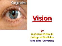 Vision By Dr/SALAH ELMALIK