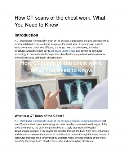 How CT scans of the chest work: What You Need to Know