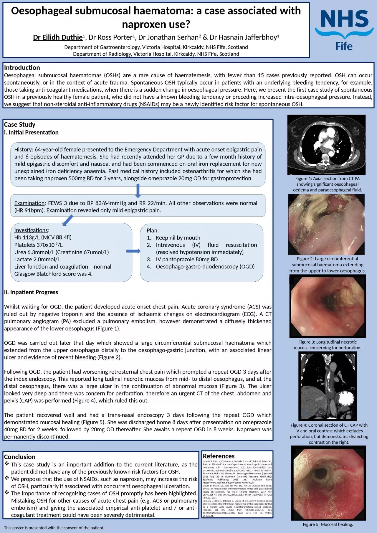 PPT-Oesophageal submucosal haematoma: a case associated with naproxen use?