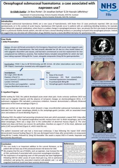 Oesophageal submucosal haematoma: a case associated with naproxen use?