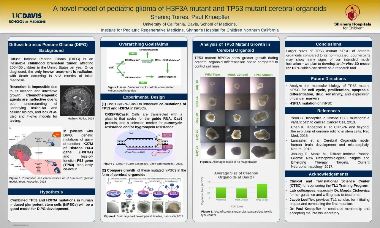 PPT-Diffuse Intrinsic Pontine Glioma (DIPG) is an