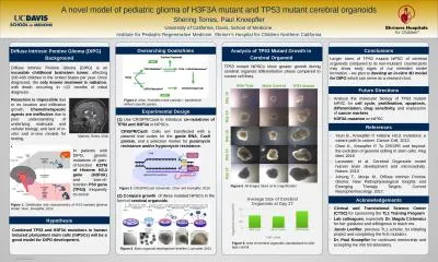 Diffuse Intrinsic Pontine Glioma (DIPG) is an