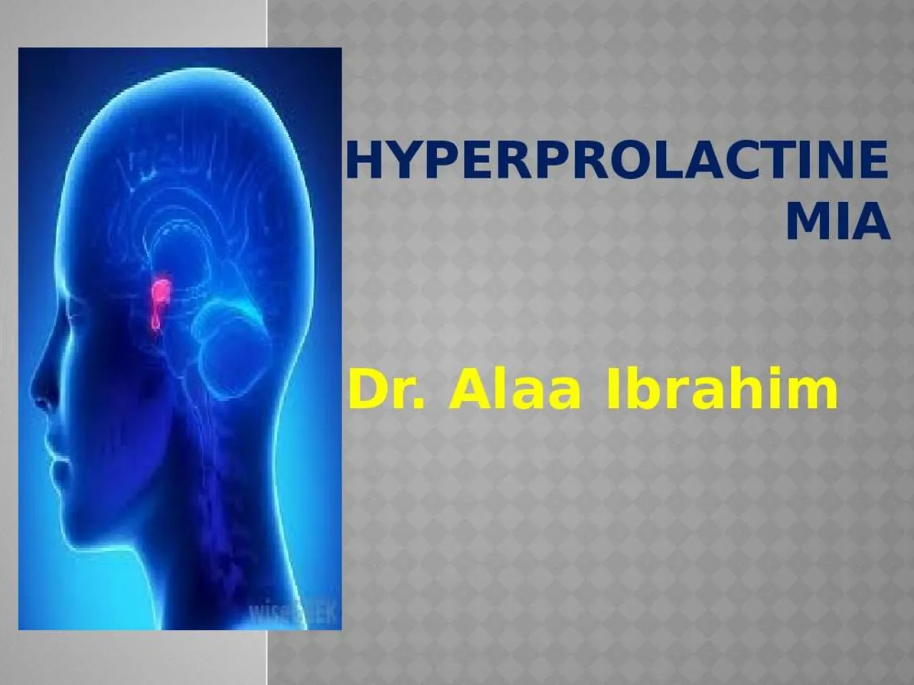 PPT-Hyperprolactinemia Dr. A