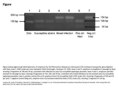 Figure Figure.&nbsp;Agarose gel electrophoresis of amplicons for the Plasmodium falciparum chlo