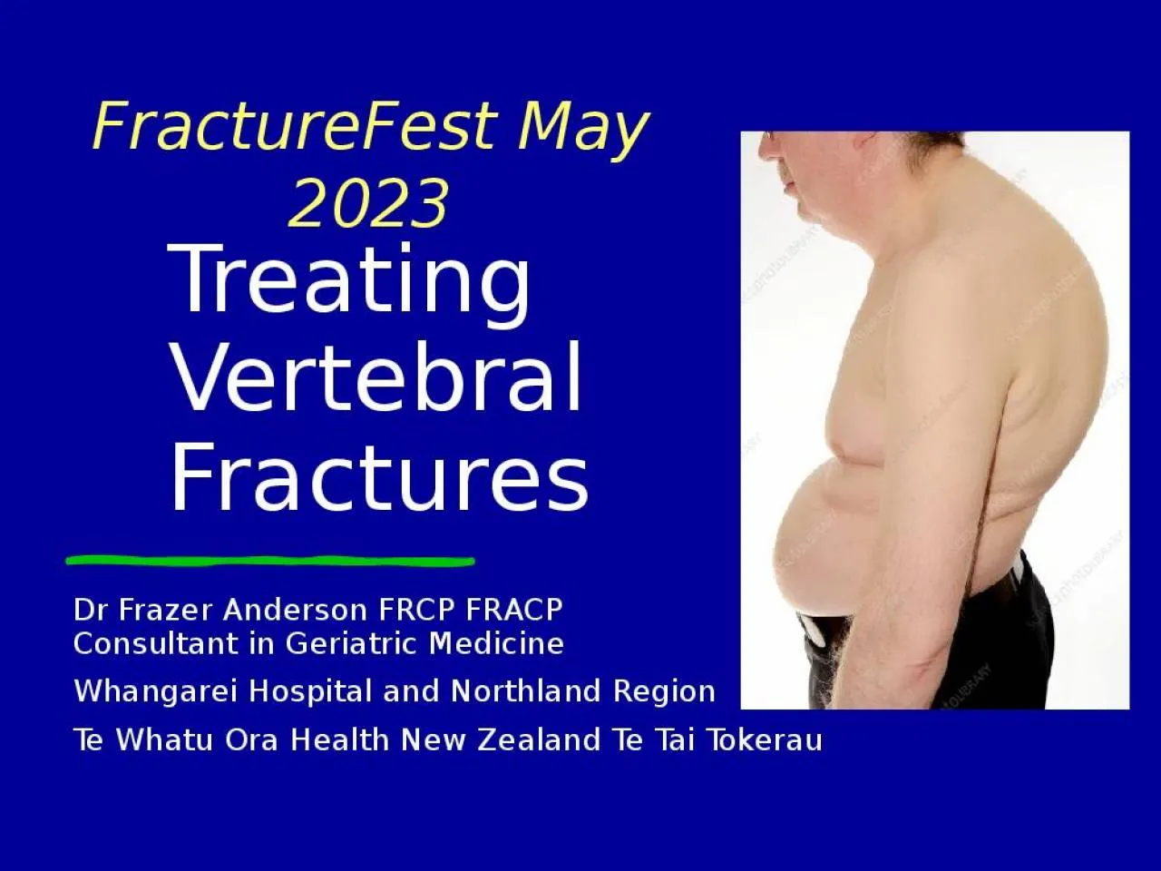 PPT-Treating Vertebral Fractures