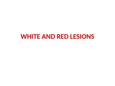 WHITE AND RED LESIONS A white appearance of the oral mucosa may be caused by a variety of factors:-