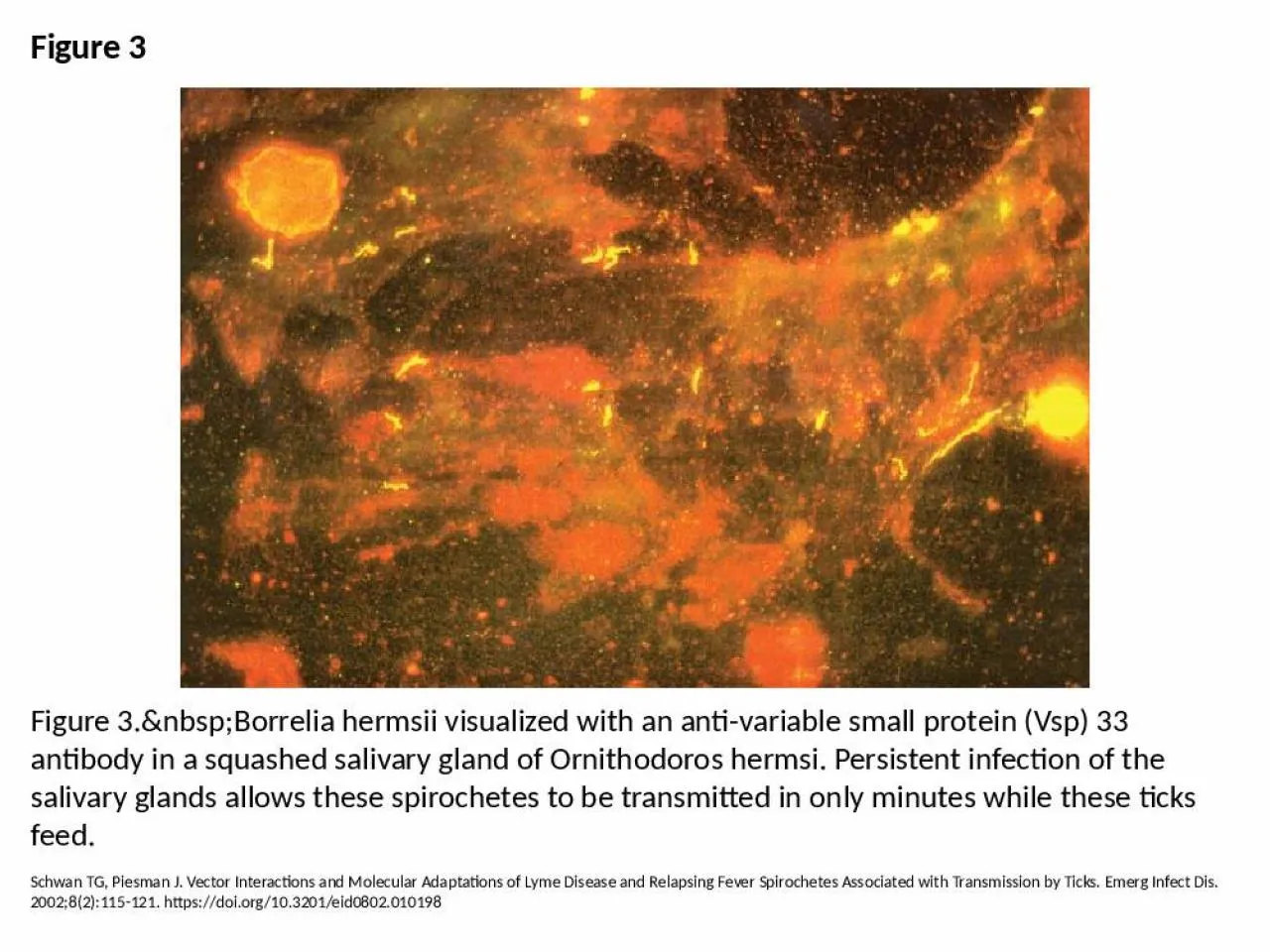 PPT-Figure 3 Figure 3.&nbsp;Borrelia hermsii visualized with an anti-variable small protein