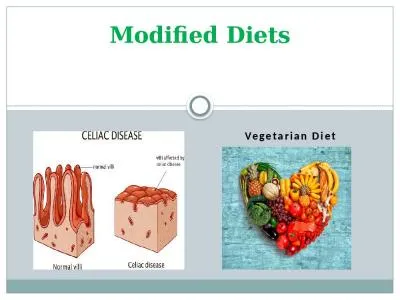 Modified Diets     Vegetarian Diet