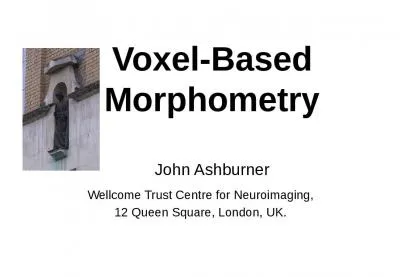 Voxel -Based  Morphometry