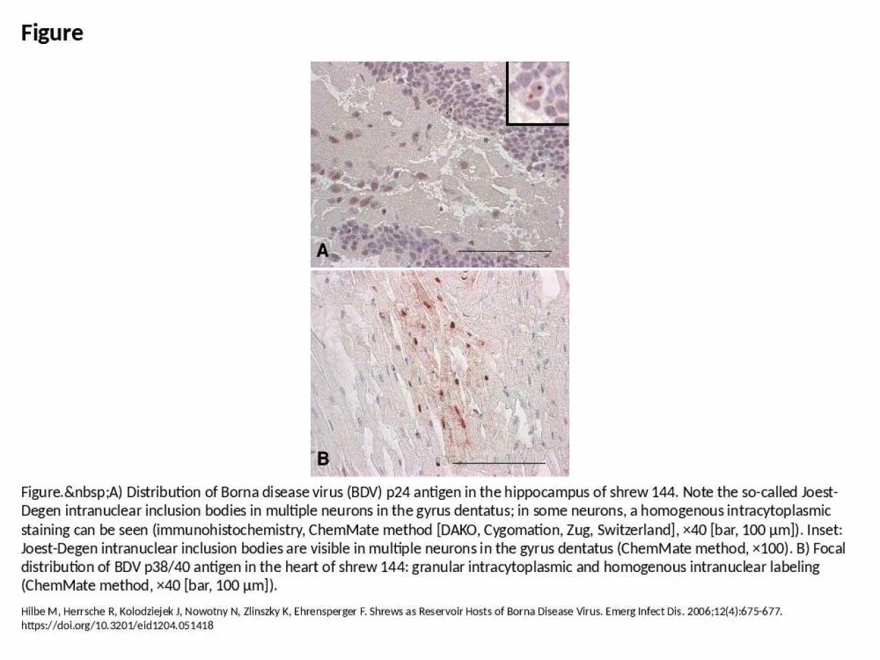 PPT-Figure Figure.&nbsp;A) Distribution of Borna disease virus (BDV) p24 antigen in the