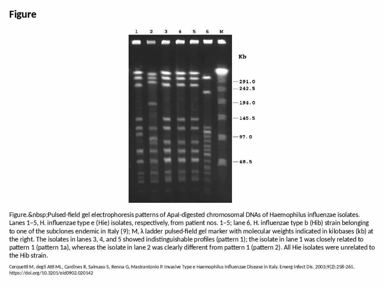 PPT-Figure Figure.&nbsp;Pulsed-field gel electrophoresis patterns of ApaI-digested chromosomal