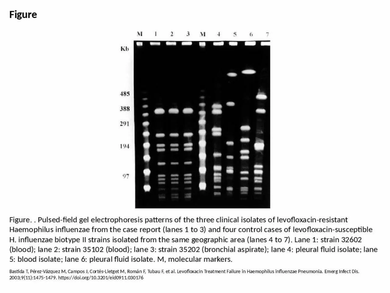 PPT-Figure Figure. . Pulsed-field gel electrophoresis patterns of the three clinical isolates