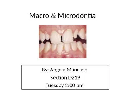 Macro &  Microdontia