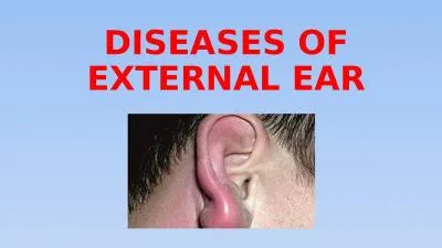 DISEASES  OF  EXTERNAL