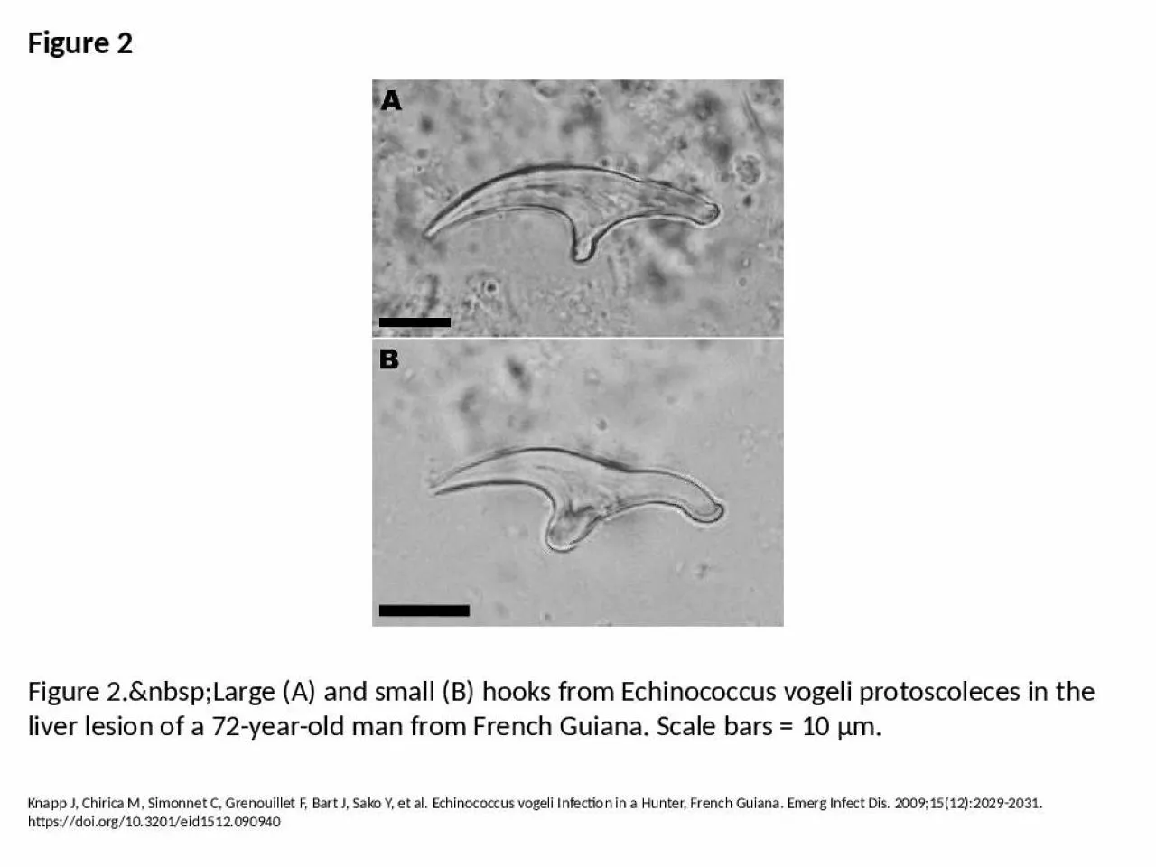 PPT-Figure 2 Figure 2.&nbsp;Large (A) and small (B) hooks from Echinococcus vogeli protoscoleces