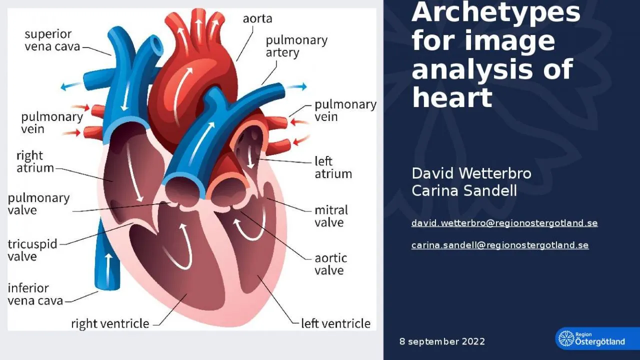 PPT-Archetypes for image analysis of heart