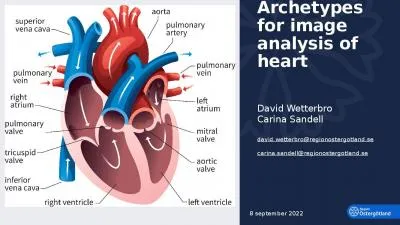 Archetypes for image analysis of heart