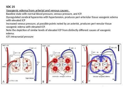 SDC  25 Vasogenic  edema from arterial and venous causes