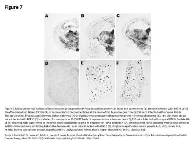 Figure 7 Figure 7.&nbsp;Abnormal isoform of host-encoded prion protein (PrPSc) deposition