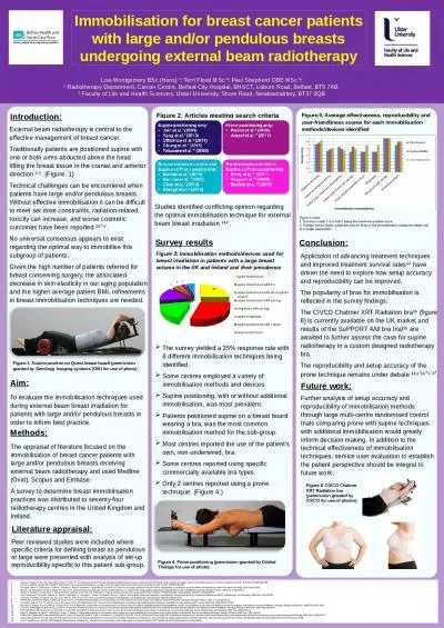 Immobilisation for breast cancer patients with large and/or pendulous breasts undergoing external b