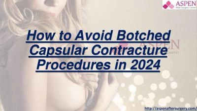 How to Avoid Botched Capsular Contracture Procedures in 2024