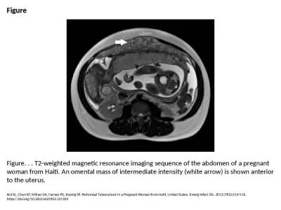 Figure Figure. . . T2-weighted magnetic resonance imaging sequence of the abdomen of a pregnant wom