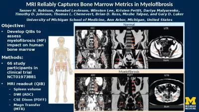 MRI Reliably Captures Bone Marrow Metrics in Myelofibrosis