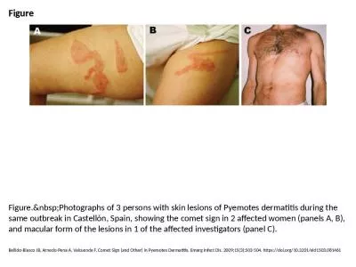 Figure Figure.&nbsp;Photographs of 3 persons with skin lesions of Pyemotes dermatitis