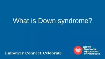 What is Down syndrome? Why is it called Down syndrome?