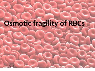 Osmotic fragility of RBCs