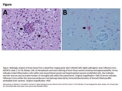 Figure Figure. Histologic analysis of brain tissue from a dead free-ranging polar bear infected wit