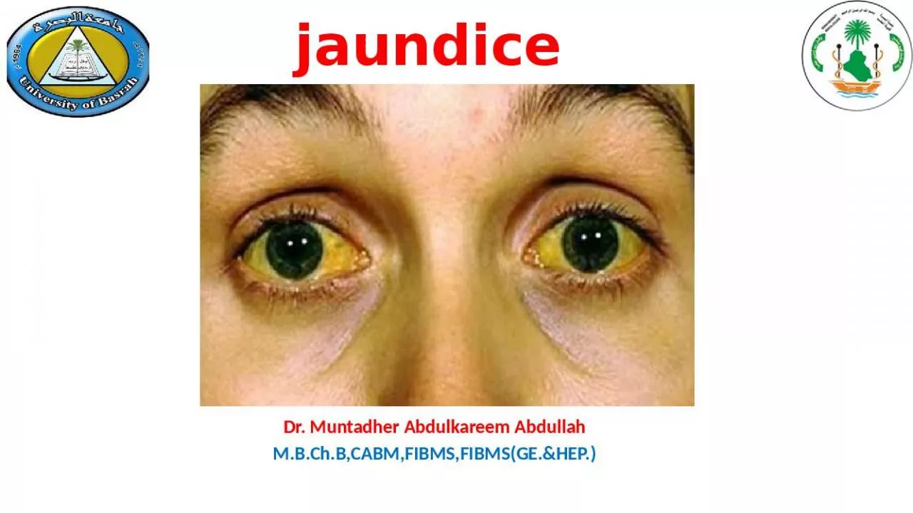 PPT-jaundice Dr. Muntadher Abdulkareem Abdullah