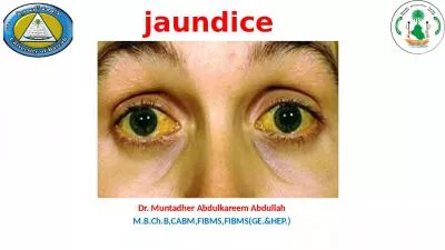 jaundice Dr. Muntadher Abdulkareem Abdullah