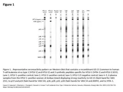 Figure 1 Figure 1. . Representative seroreactivity pattern on Western blot that contains