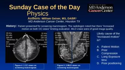 Sunday Case of the Day History