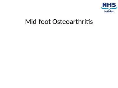 Mid-foot Osteoarthritis Contents