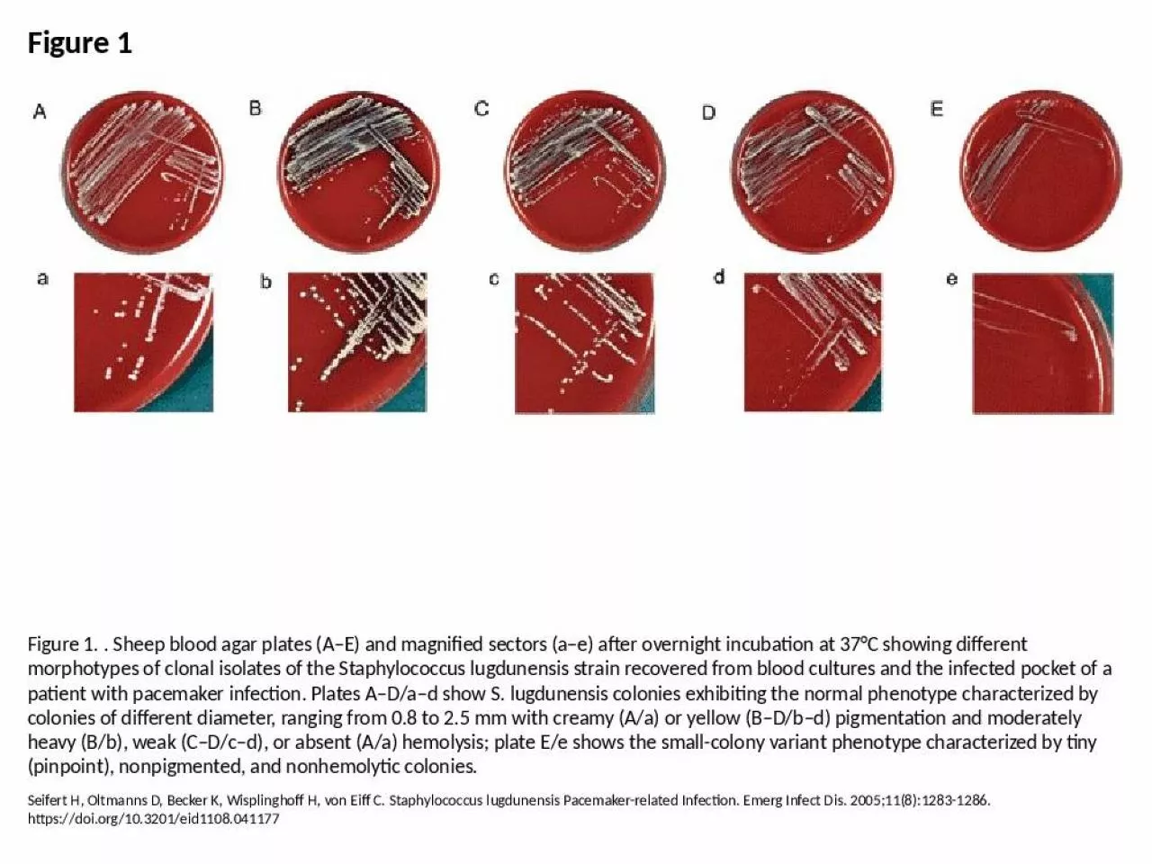 PPT-Figure 1 Figure 1. . Sheep blood agar plates (A–E) and magnified sectors (a–e) after