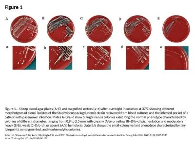 Figure 1 Figure 1. . Sheep blood agar plates (A–E) and magnified sectors (a–e) after